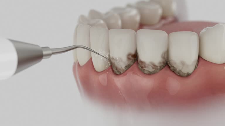 Reliable Dental Crowns And Bridges contractor in Lincoln Parish County, LA by Dentist Open Now